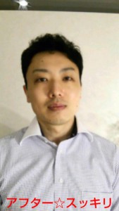 アフター